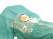 Cesarean Section Drapes